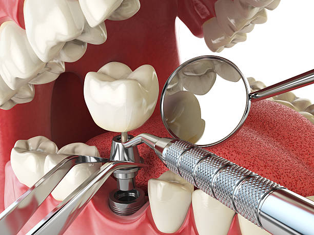 Best Emergency Cosmetic Dentistry in College, AK
