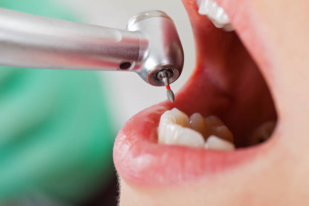 Best Urgent Dental Care for Toothache in College, AK